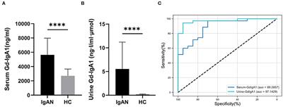 Gut Dysbiosis and Intestinal Barrier Dysfunction Promotes IgA Nephropathy by Increasing the Production of Gd-IgA1